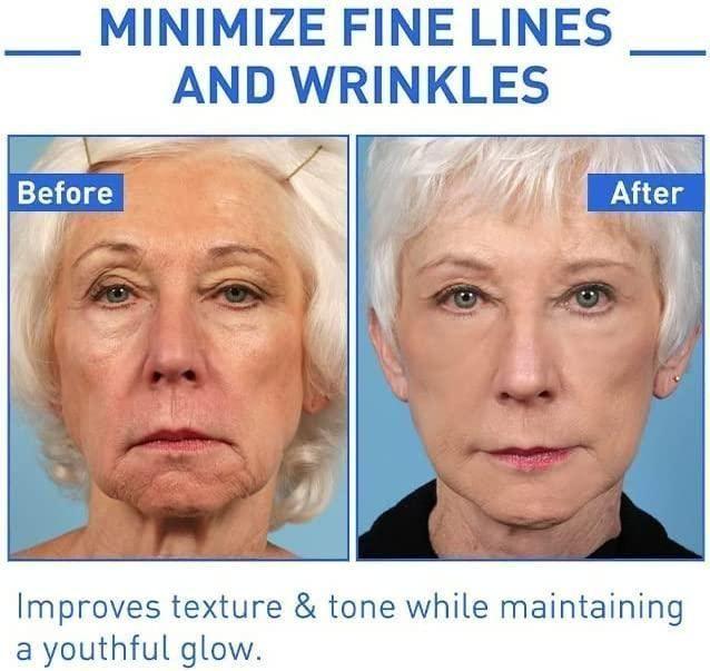 Botox Anti-Aging Serum (Buy 1 Get 1 FREE🔥)
