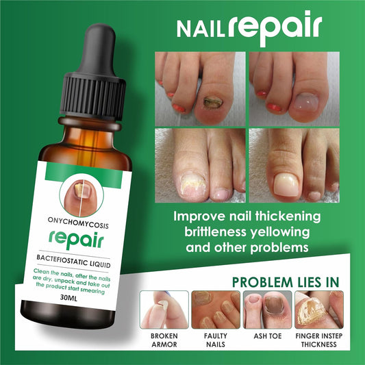 NailCure™ All in one Nail Repair Serum ( Buy 1 Get 1 Free)