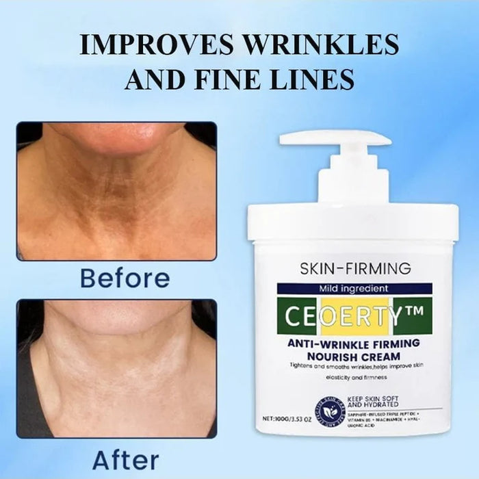 Anti-Wrinkle Multi-purpose Cream - 🔥 50% Discount Only Today  🔥